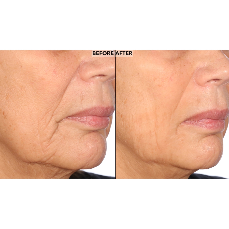 Image 109836_ALTMORE7.jpg, Product 109-836 / Price $50.00, Nakery Skip The Line Advanced Instant Wrinkle Eraser from Nakery Beauty on TSC.ca's Beauty department