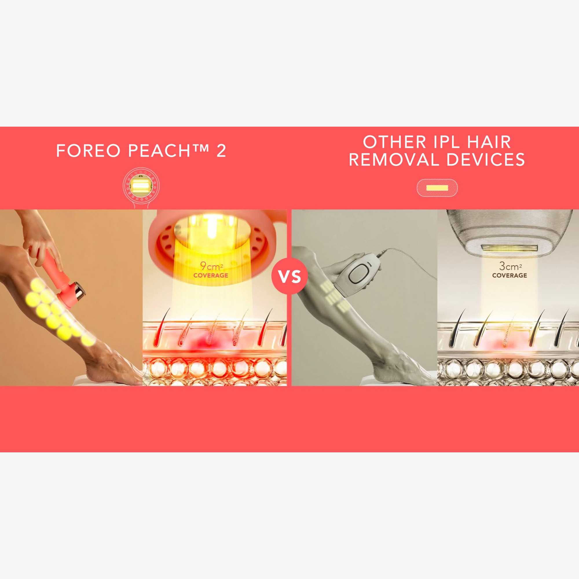 Foreo Peach 2 IPL Hair Removal Device - TSC.ca