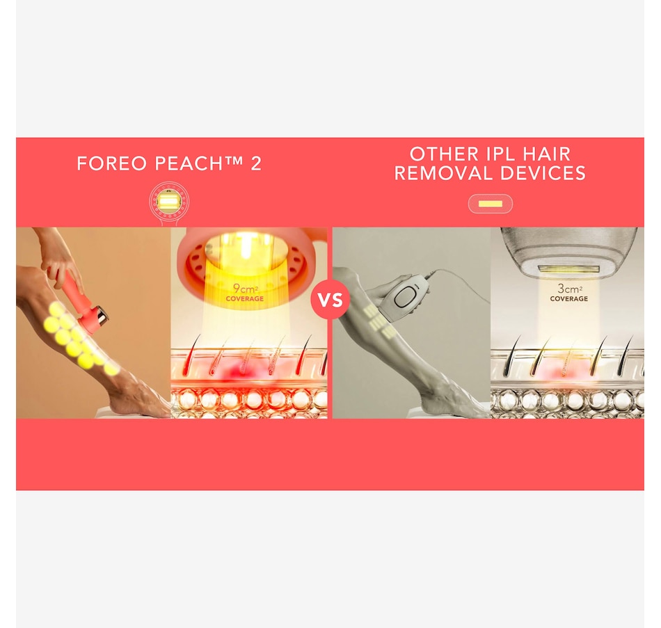 Image 109882_ALTMORE12.jpg, Product 109-882 / Price $589.00, Foreo Peach 2 IPL Hair Removal Device from Foreo on TSC.ca's Beauty department