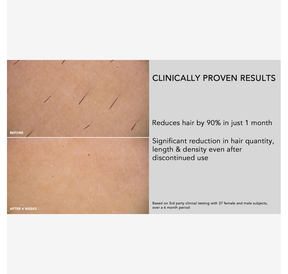 Image 109882_ALTMORE7.jpg, Product 109-882 / Price $589.00, Foreo Peach 2 IPL Hair Removal Device from Foreo on TSC.ca's Beauty department