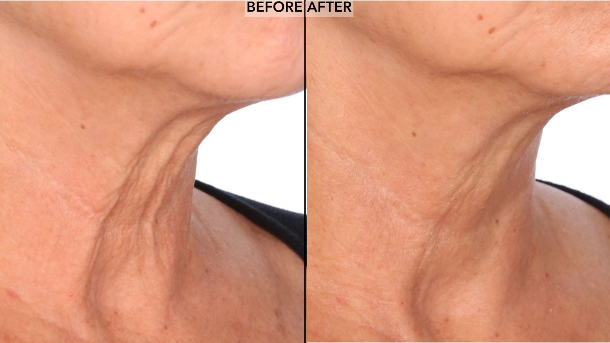 Nakery Lift-Tox Night Lift Repair Cream - TSC.ca