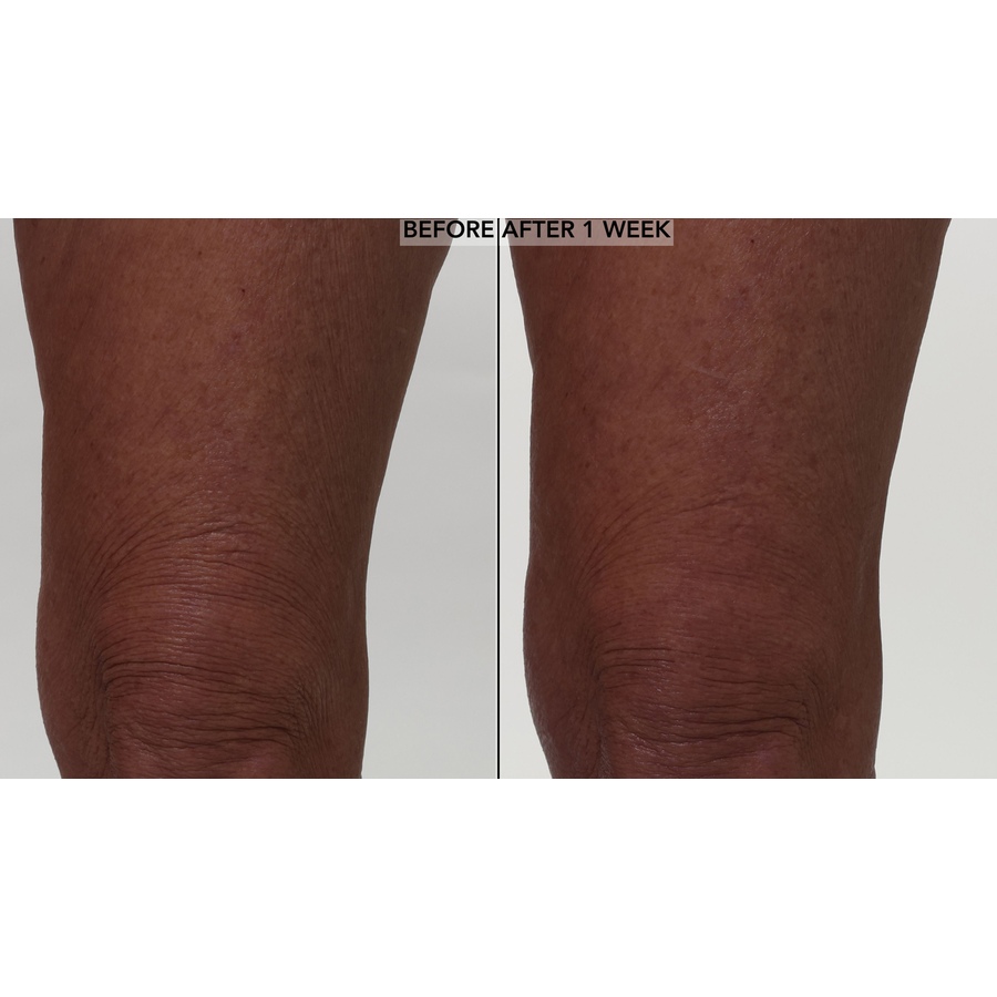 Image 110869_ALTMORE6.jpg, Product 110-869 / Price $50.00, Nakery Lift-Tox Skinfirm Body Lifting Treatment With Slimtight Complex from Nakery Beauty on TSC.ca's Beauty department