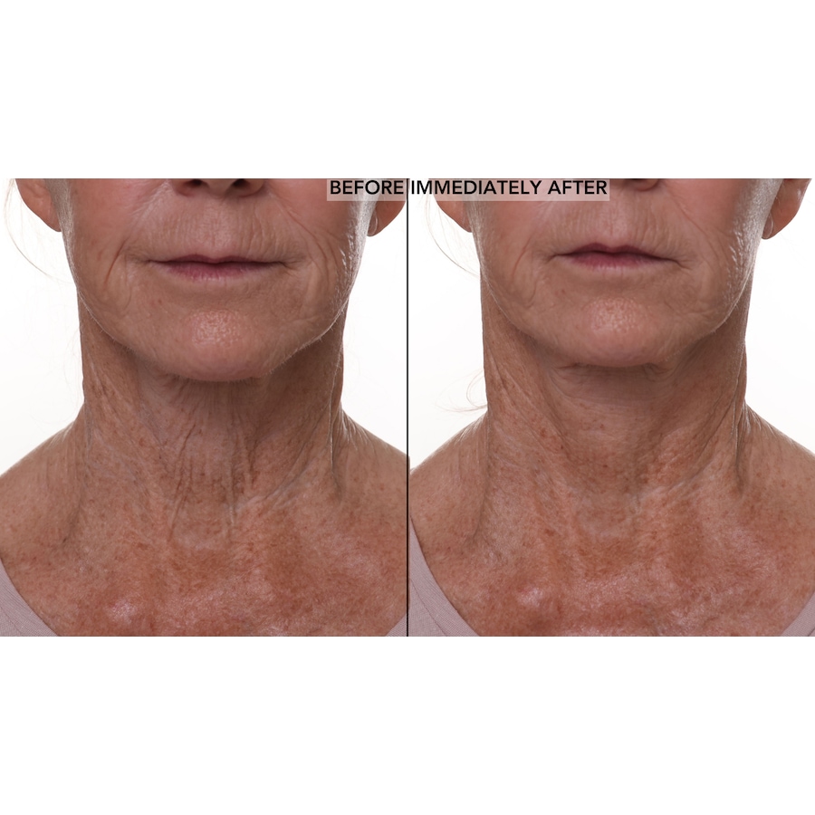 Image 110869_ALTMORE7.jpg, Product 110-869 / Price $50.00, Nakery Lift-Tox Skinfirm Body Lifting Treatment With Slimtight Complex from Nakery Beauty on TSC.ca's Beauty department