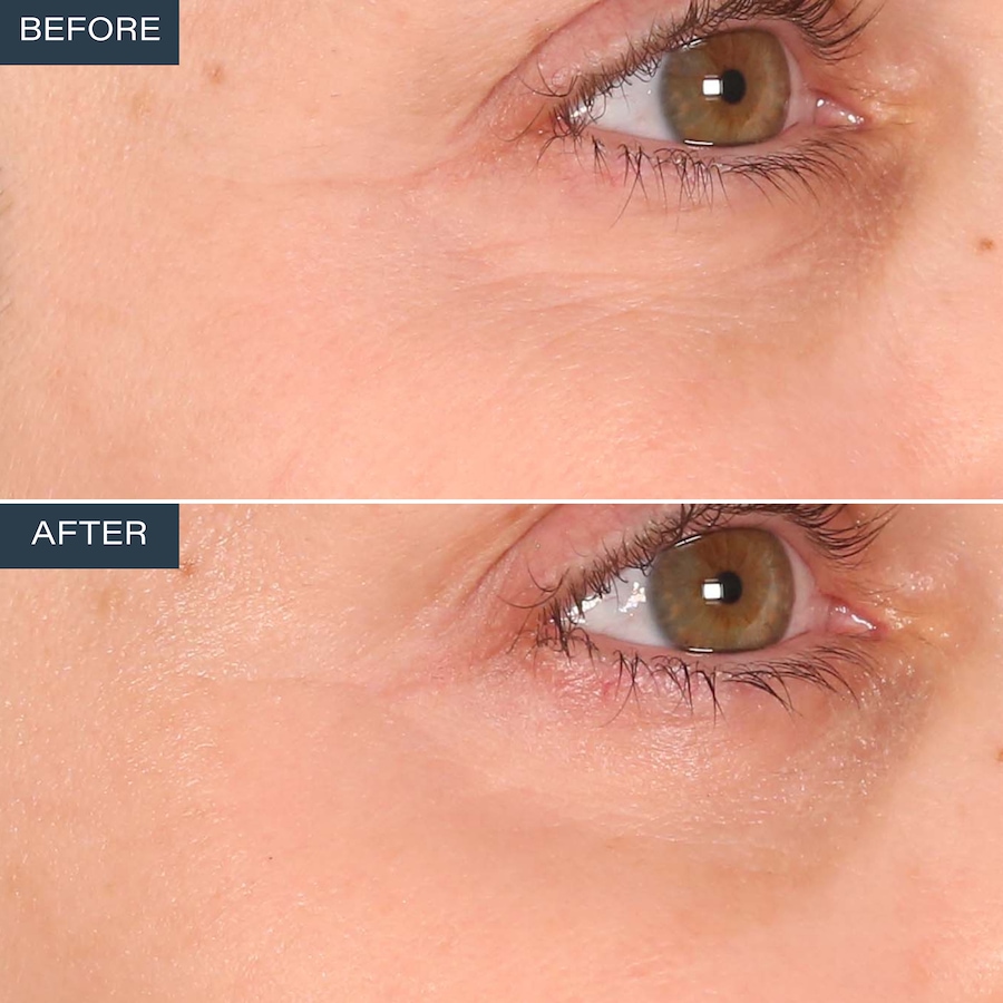 Image 110873_ALTMORE5.jpg, Product 110-873 / Price $59.99, SKINN Age Reset Anhydrous Eye Balm from SKINN on TSC.ca's Beauty department