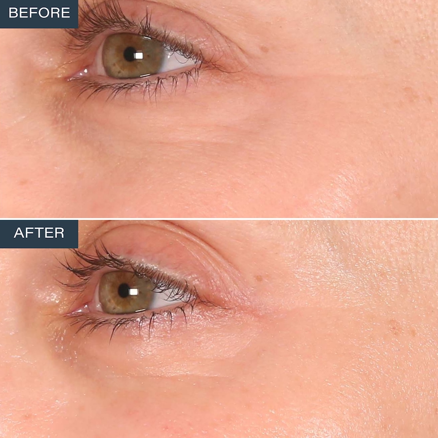Image 110873_ALTMORE6.jpg, Product 110-873 / Price $59.99, SKINN Age Reset Anhydrous Eye Balm from SKINN on TSC.ca's Beauty department