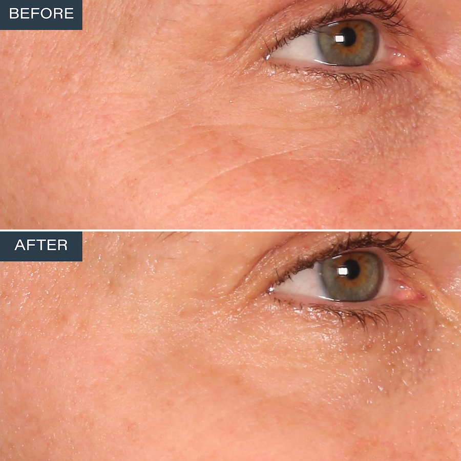 Image 110873_ALTMORE7.jpg, Product 110-873 / Price $59.99, SKINN Age Reset Anhydrous Eye Balm from SKINN on TSC.ca's Beauty department