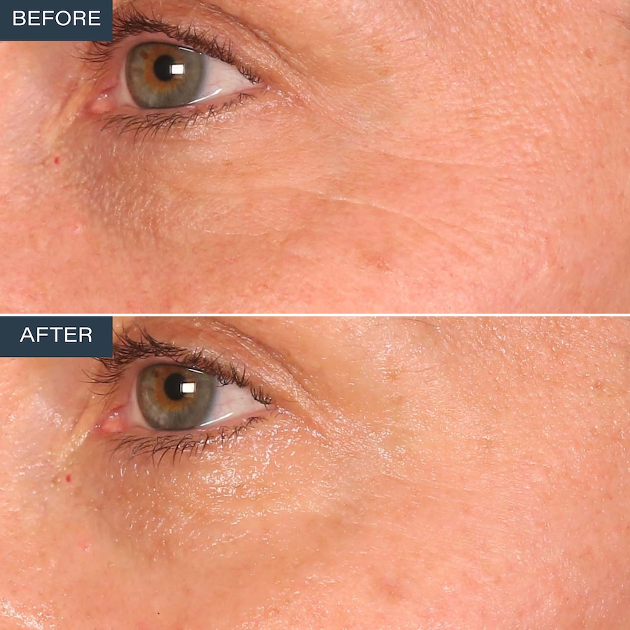 Image 110873_ALTMORE8.jpg, Product 110-873 / Price $59.99, SKINN Age Reset Anhydrous Eye Balm from SKINN on TSC.ca's Beauty department
