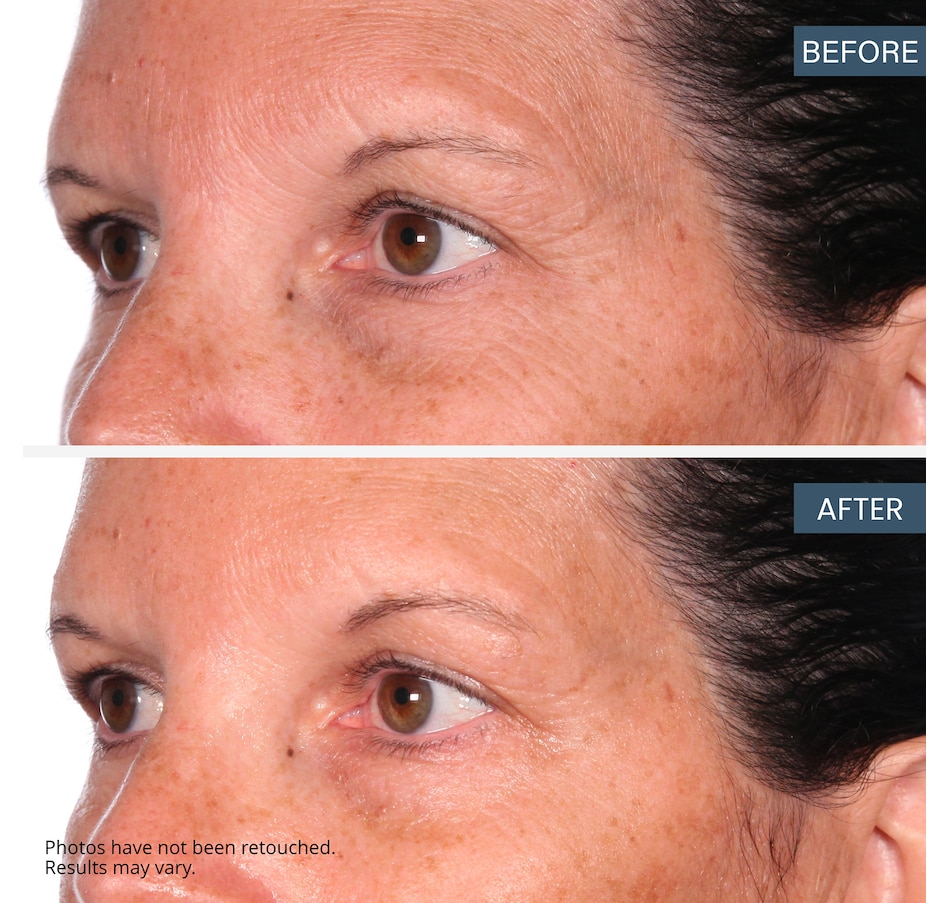 Image 111463_ALTMORE7.jpg, Product 111-463 / Price $34.99, SKINN Mini Elixir Ayurvedic Oil from SKINN on TSC.ca's Beauty department