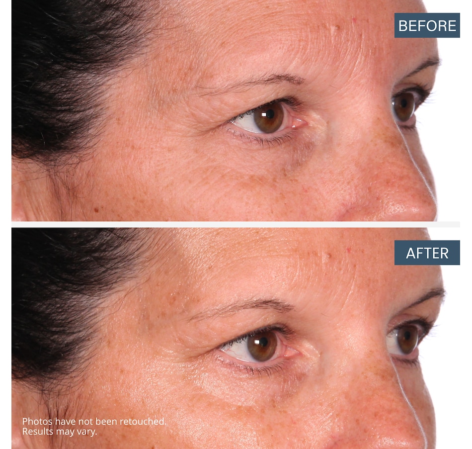 Image 111463_ALTMORE8.jpg, Product 111-463 / Price $34.99, SKINN Mini Elixir Ayurvedic Oil from SKINN on TSC.ca's Beauty department