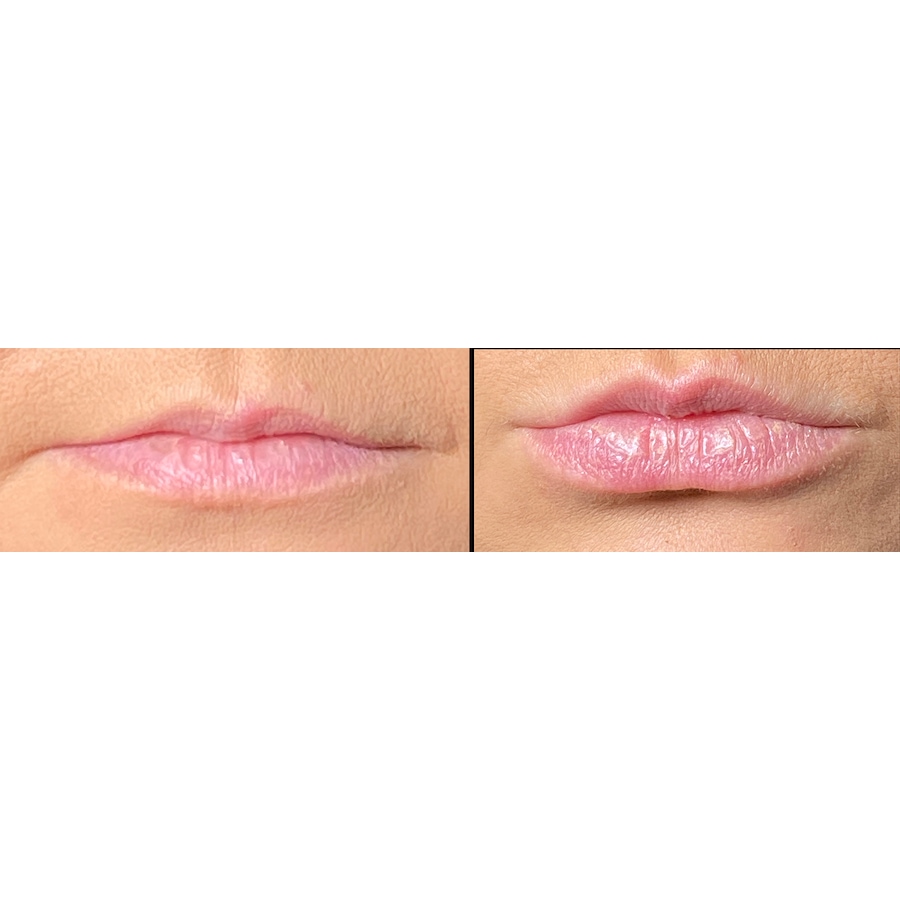 Image 111578_ALTMORE6.jpg, Product 111-578 / Price $180.00, Lab Life Beauty Lip Plumper from Lab Life Beauty on TSC.ca's Beauty department