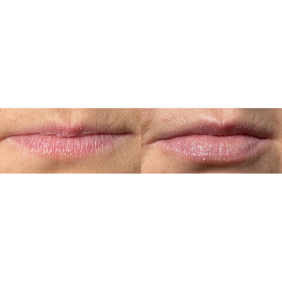 Image 111578_ALTMORE7.jpg, Product 111-578 / Price $180.00, Lab Life Beauty Lip Plumper from Lab Life Beauty on TSC.ca's Beauty department