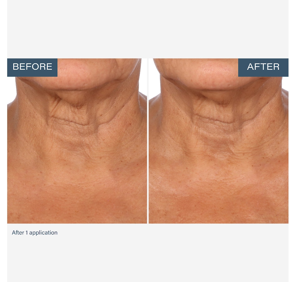 Image 111905_ALTMORE3.jpg, Product 111-905 / Price $55.00, SKINN Neck Amour Advanced Leave-On Mask from SKINN on TSC.ca's Beauty department