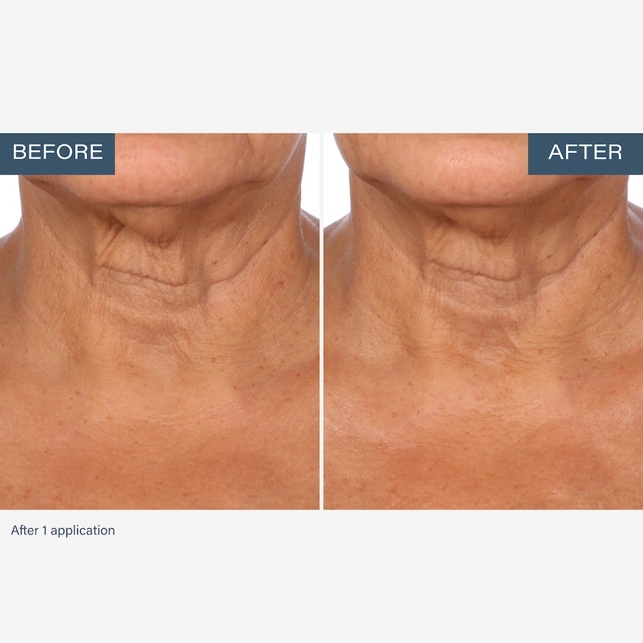 Image 111905_ALTMORE3.jpg, Product 111-905 / Price $55.00, SKINN Neck Amour Advanced Leave-On Mask from SKINN on TSC.ca's Beauty department