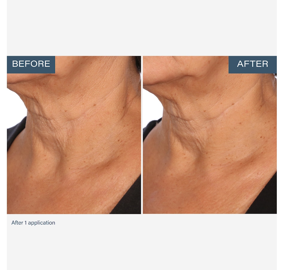 Image 111905_ALTMORE4.jpg, Product 111-905 / Price $55.00, SKINN Neck Amour Advanced Leave-On Mask from SKINN on TSC.ca's Beauty department