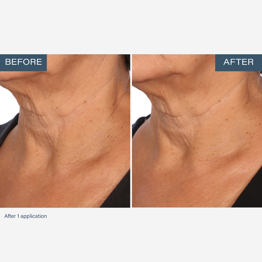 Image 111905_ALTMORE4.jpg, Product 111-905 / Price $55.00, SKINN Neck Amour Advanced Leave-On Mask from SKINN on TSC.ca's Beauty department