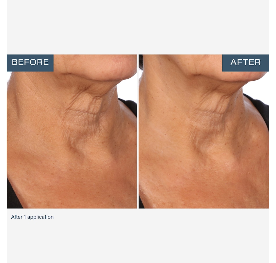 Image 111905_ALTMORE5.jpg, Product 111-905 / Price $55.00, SKINN Neck Amour Advanced Leave-On Mask from SKINN on TSC.ca's Beauty department