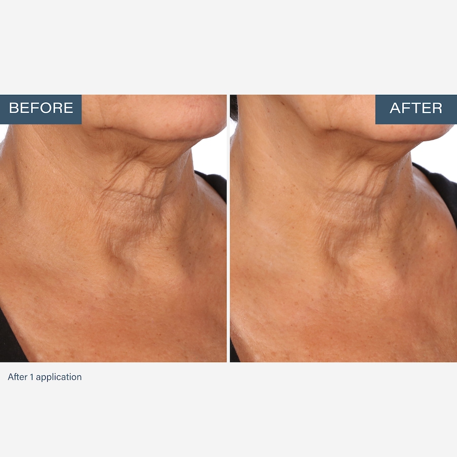 Image 111905_ALTMORE5.jpg, Product 111-905 / Price $55.00, SKINN Neck Amour Advanced Leave-On Mask from SKINN on TSC.ca's Beauty department