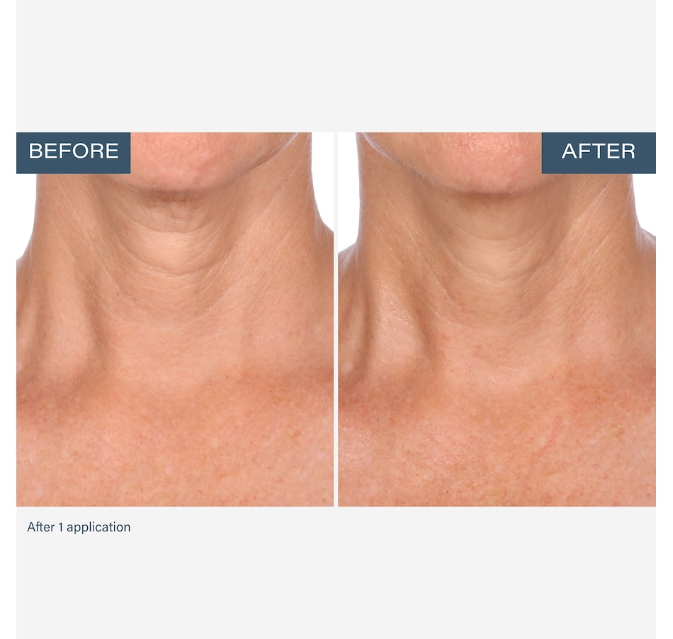 Image 111905_ALTMORE6.jpg, Product 111-905 / Price $55.00, SKINN Neck Amour Advanced Leave-On Mask from SKINN on TSC.ca's Beauty department