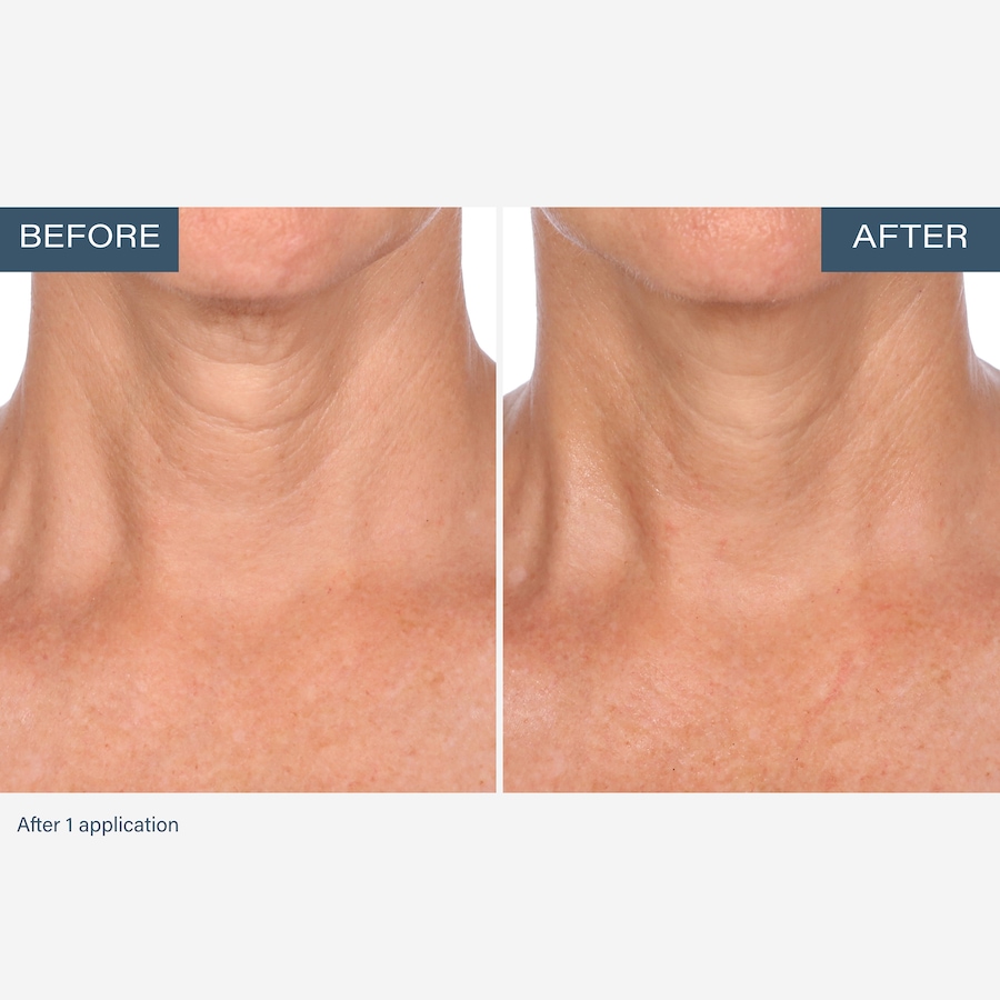 Image 111905_ALTMORE6.jpg, Product 111-905 / Price $55.00, SKINN Neck Amour Advanced Leave-On Mask from SKINN on TSC.ca's Beauty department