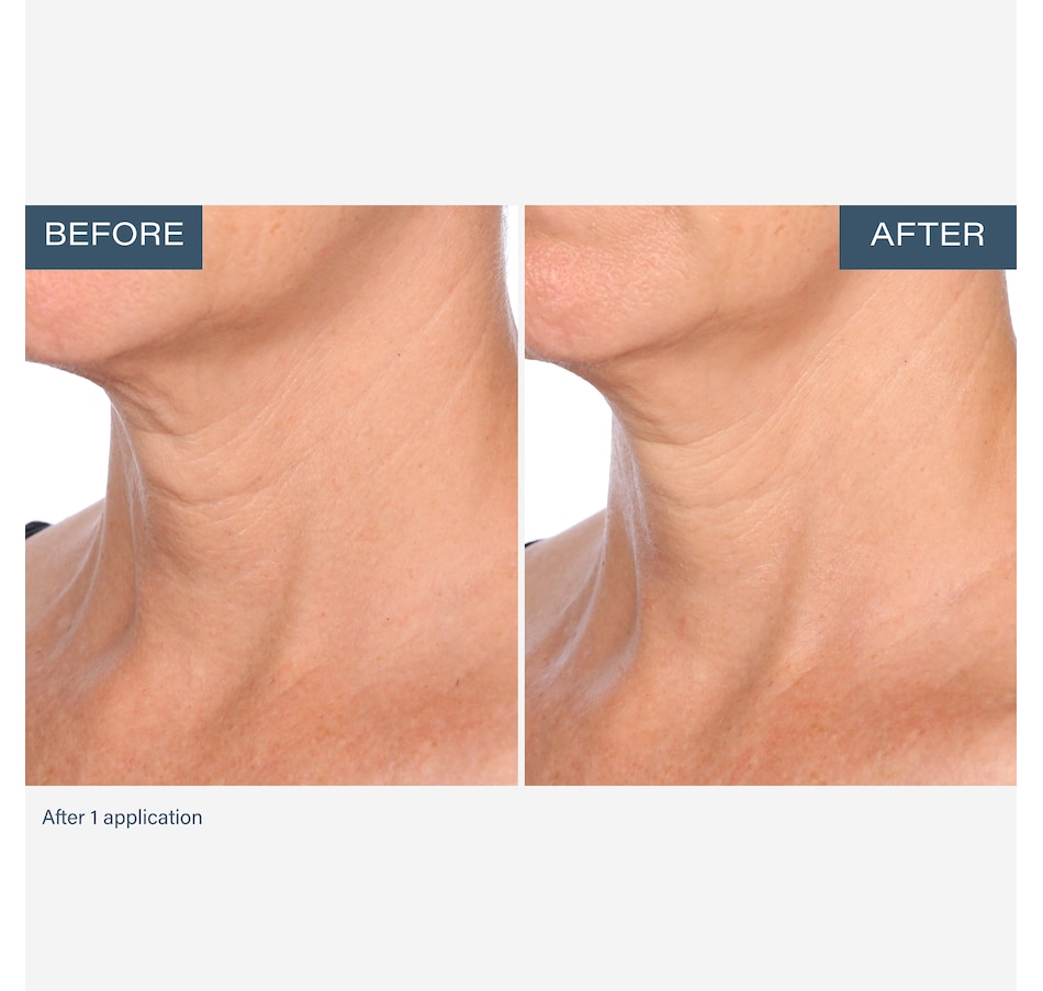 Image 111905_ALTMORE7.jpg, Product 111-905 / Price $55.00, SKINN Neck Amour Advanced Leave-On Mask from SKINN on TSC.ca's Beauty department