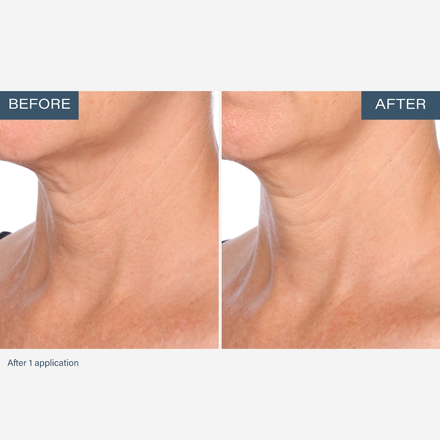 Image 111905_ALTMORE7.jpg, Product 111-905 / Price $55.00, SKINN Neck Amour Advanced Leave-On Mask from SKINN on TSC.ca's Beauty department