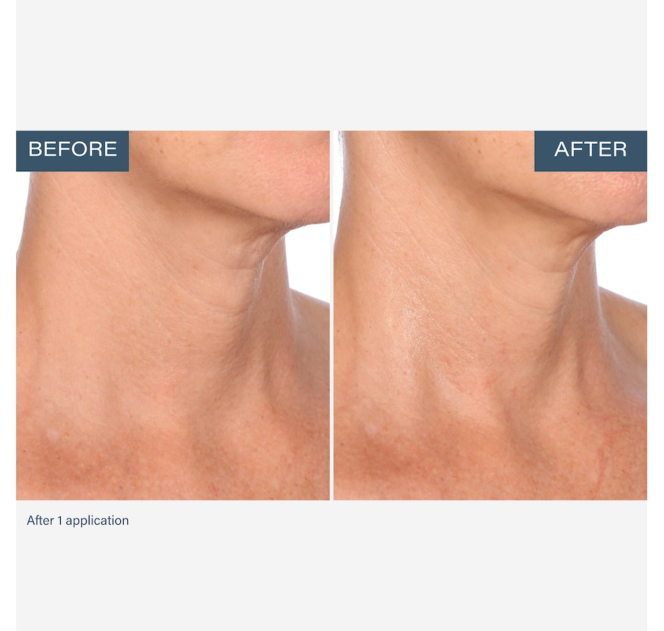 Image 111905_ALTMORE8.jpg, Product 111-905 / Price $55.00, SKINN Neck Amour Advanced Leave-On Mask from SKINN on TSC.ca's Beauty department