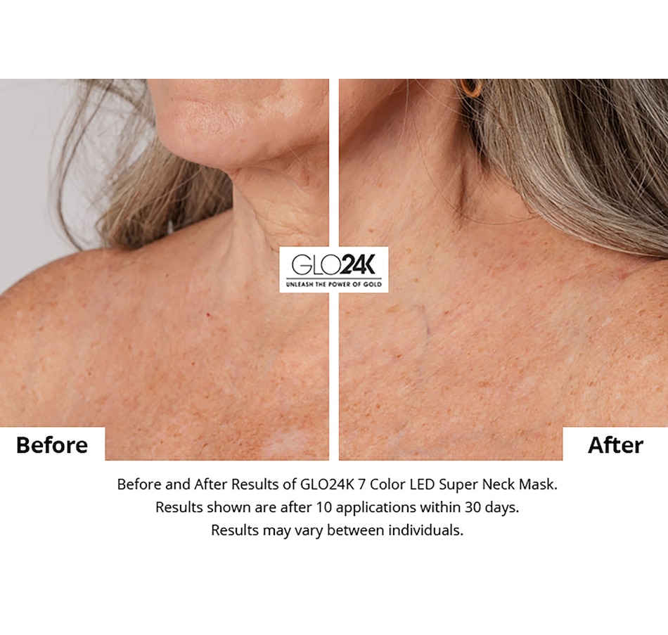 Image 111930_ALTMORE1.jpg, Product 111-930 / Price $650.00, GLO24K Colour LED Super Mask For the Neck, Chest, and Décolleté from GLO24k on TSC.ca's Beauty department