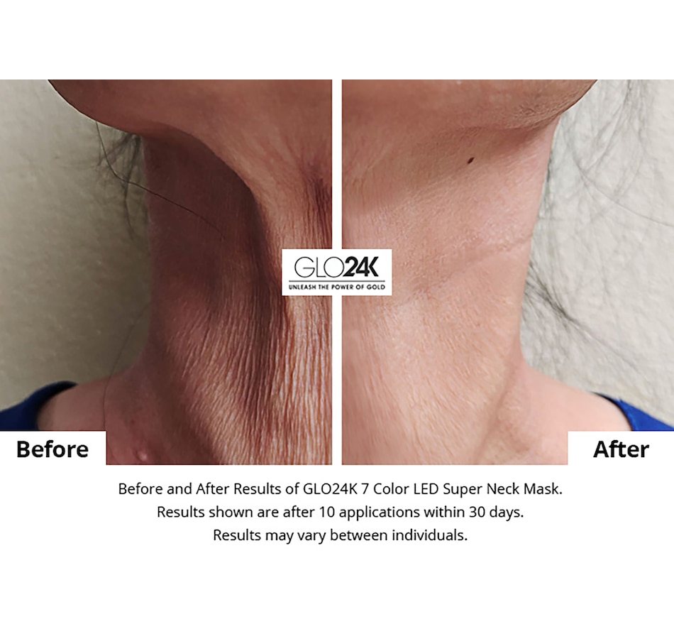 Image 111930_ALTMORE2.jpg, Product 111-930 / Price $650.00, GLO24K Colour LED Super Mask For the Neck, Chest, and Décolleté from GLO24k on TSC.ca's Beauty department