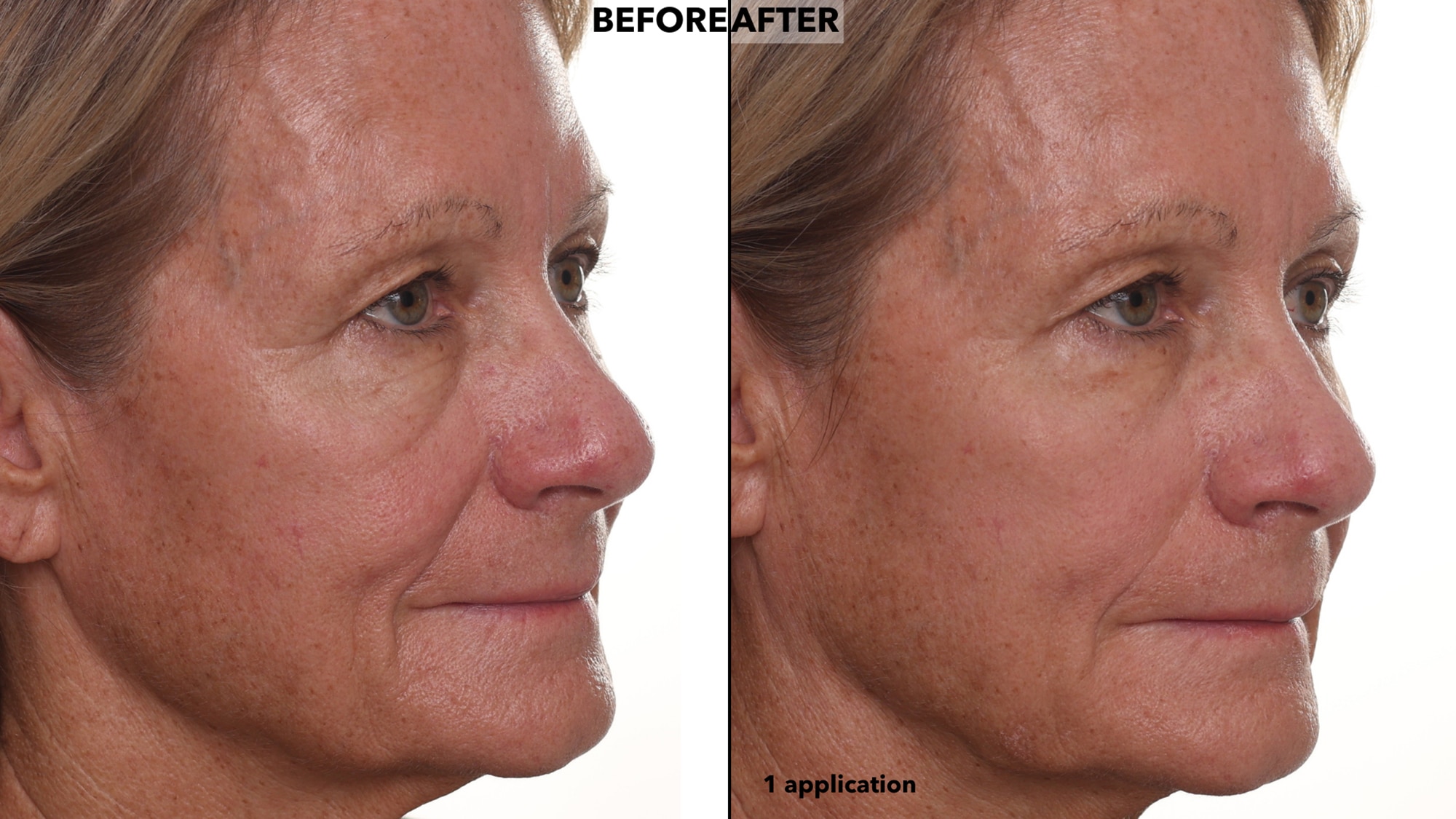 Nakery Lift-Tox Face and Eye Bundle - TSC.ca