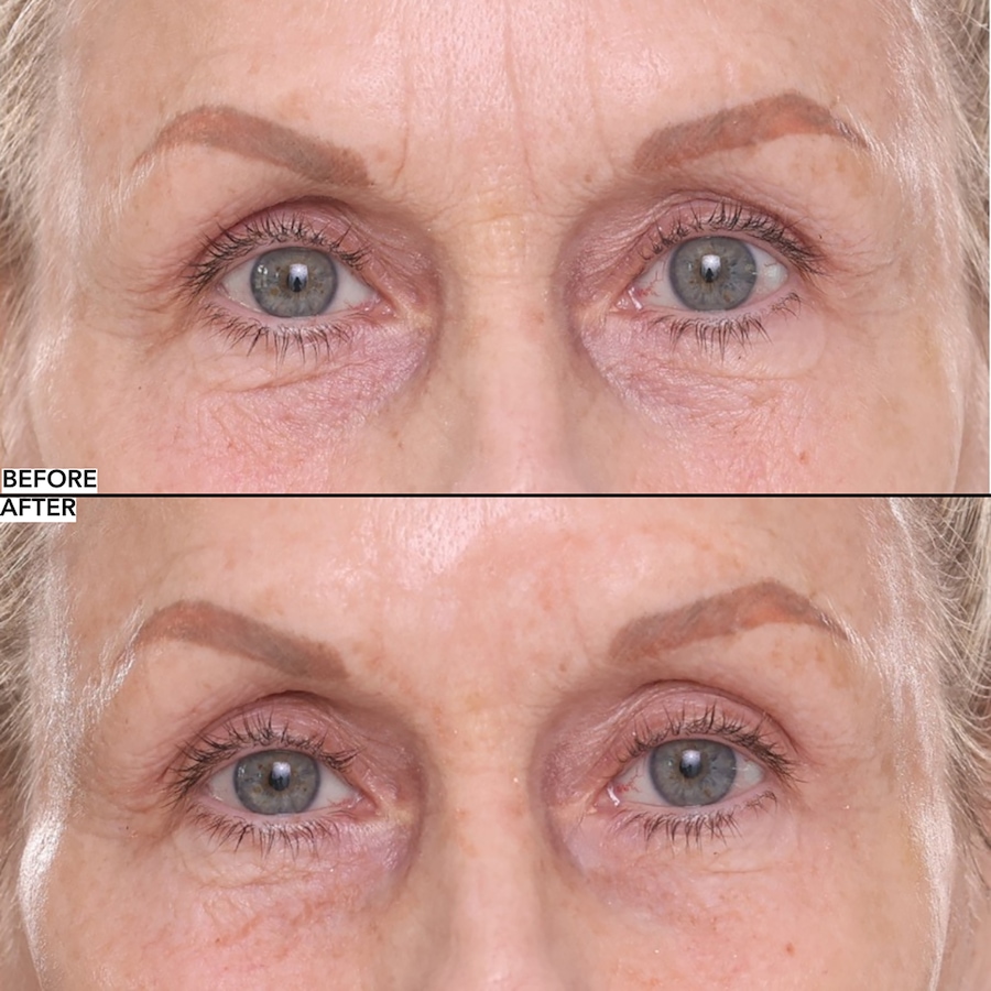 Image 112582_ALTMORE4.jpg, Product 112-582 / Price $44.50, Nakery Collagen Cushion Pressed Serum from Nakery Beauty on TSC.ca's Beauty department