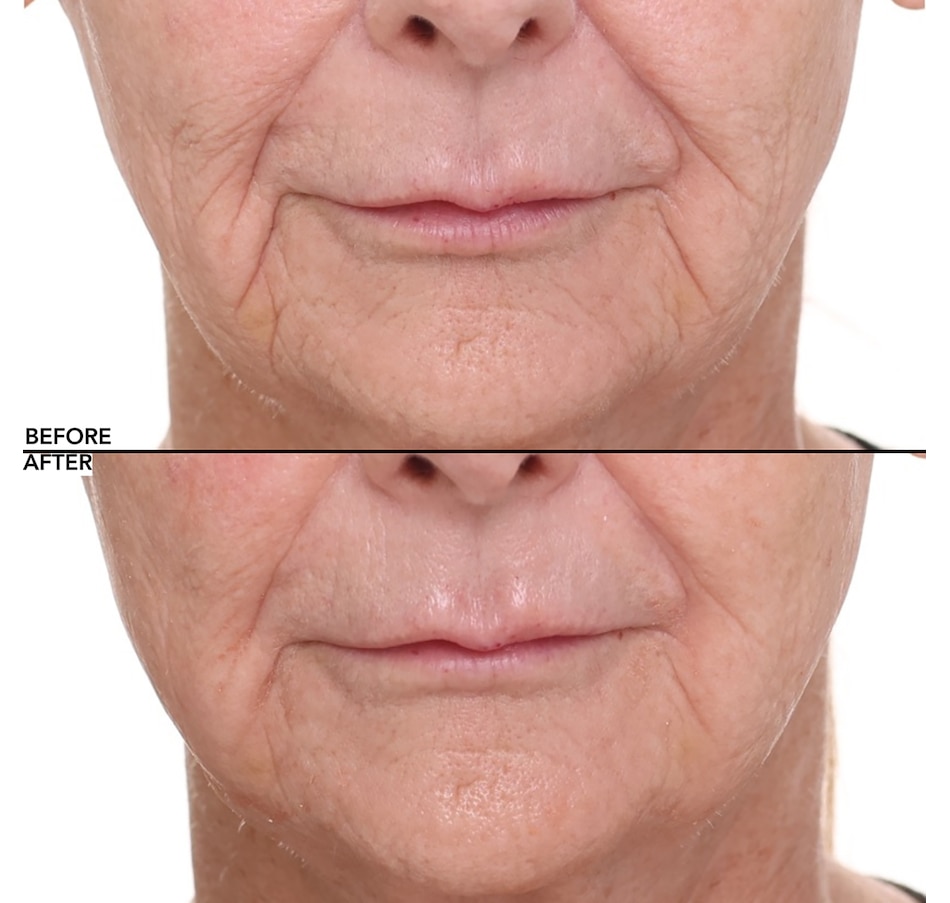 Image 112582_ALTMORE5.jpg, Product 112-582 / Price $44.50, Nakery Collagen Cushion Pressed Serum from Nakery Beauty on TSC.ca's Beauty department