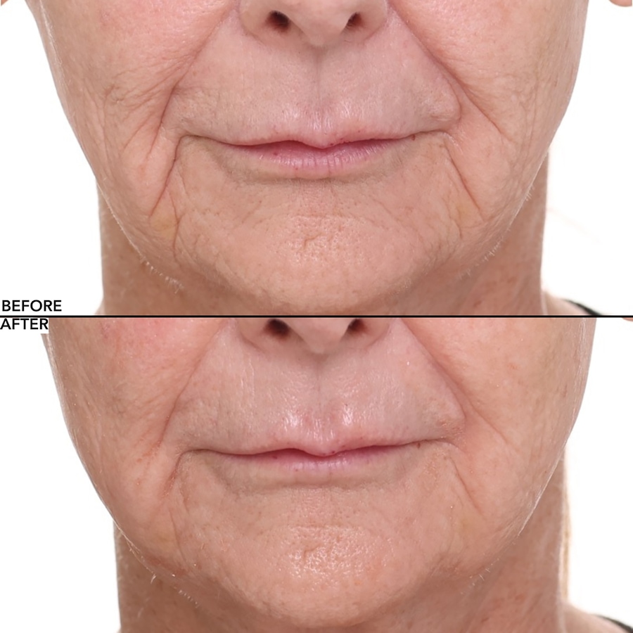 Image 112582_ALTMORE5.jpg, Product 112-582 / Price $44.50, Nakery Collagen Cushion Pressed Serum from Nakery Beauty on TSC.ca's Beauty department