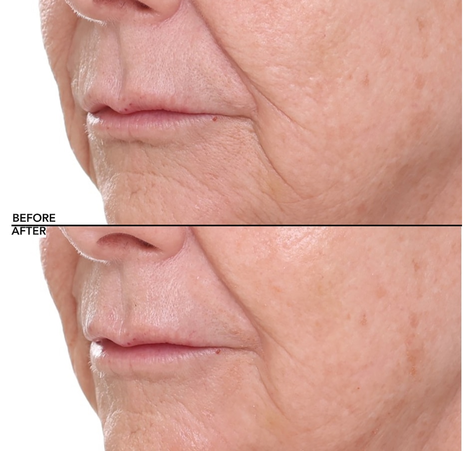 Image 112582_ALTMORE7.jpg, Product 112-582 / Price $44.50, Nakery Collagen Cushion Pressed Serum from Nakery Beauty on TSC.ca's Beauty department