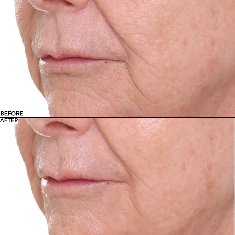 Image 112582_ALTMORE7.jpg, Product 112-582 / Price $44.50, Nakery Collagen Cushion Pressed Serum from Nakery Beauty on TSC.ca's Beauty department