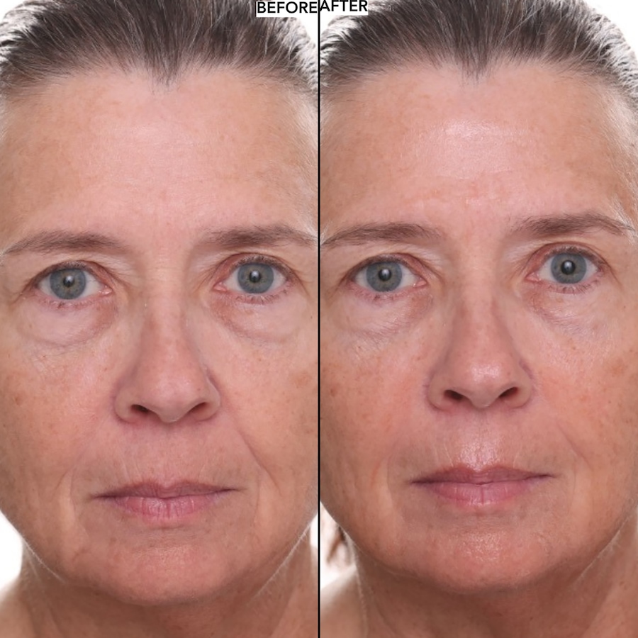 Image 112582_ALTMORE8.jpg, Product 112-582 / Price $44.50, Nakery Collagen Cushion Pressed Serum from Nakery Beauty on TSC.ca's Beauty department