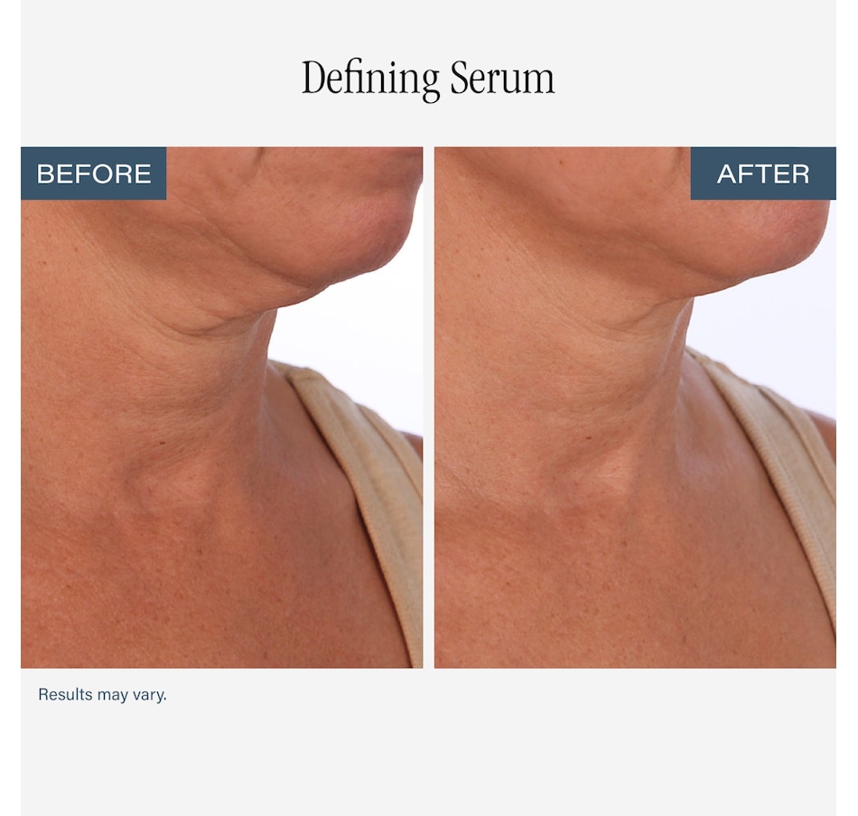 Image 112687_ALTMORE5.jpg, Product 112-687 / Price $84.00, SKINN Neck Amour Duo from SKINN on TSC.ca's Beauty department