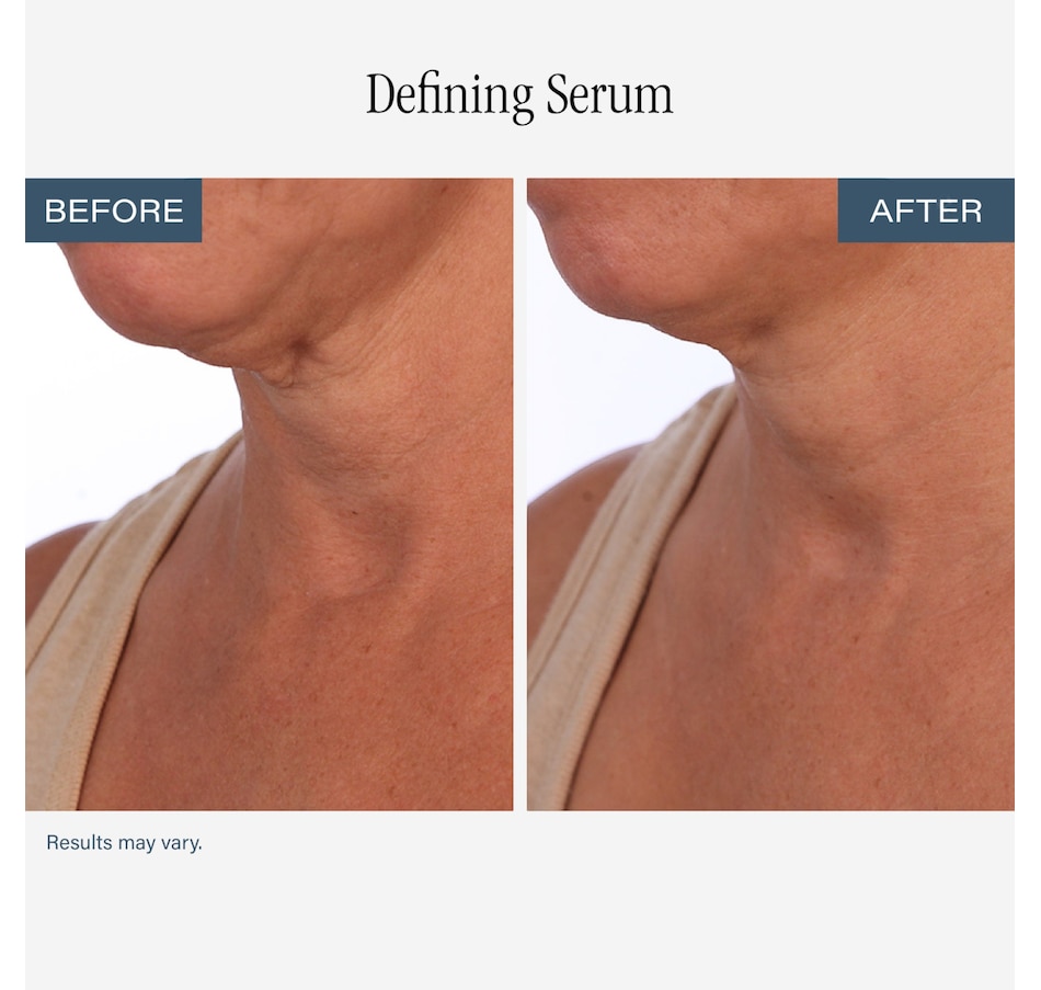 Image 112687_ALTMORE6.jpg, Product 112-687 / Price $84.00, SKINN Neck Amour Duo from SKINN on TSC.ca's Beauty department