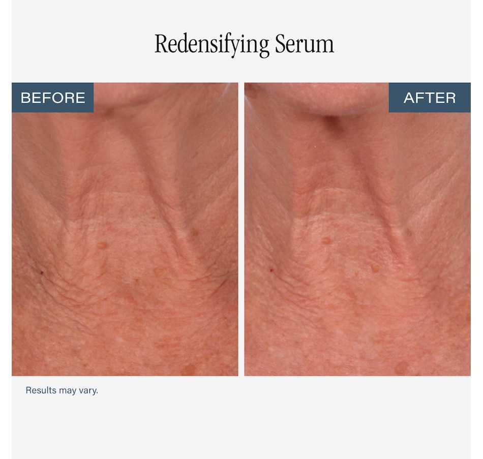 Image 112687_ALTMORE7.jpg, Product 112-687 / Price $84.00, SKINN Neck Amour Duo from SKINN on TSC.ca's Beauty department