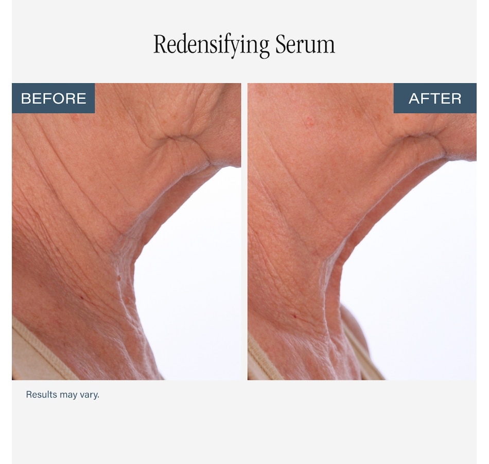 Image 112687_ALTMORE8.jpg, Product 112-687 / Price $84.00, SKINN Neck Amour Duo from SKINN on TSC.ca's Beauty department