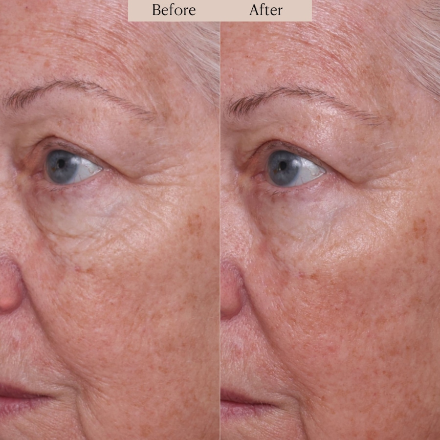 Image 112849_ALTMORE4.jpg, Product 112-849 / Price $57.00, Nakery SkinRepair Retinol Deep Wrinkle Serum from Nakery Beauty on TSC.ca's Beauty department