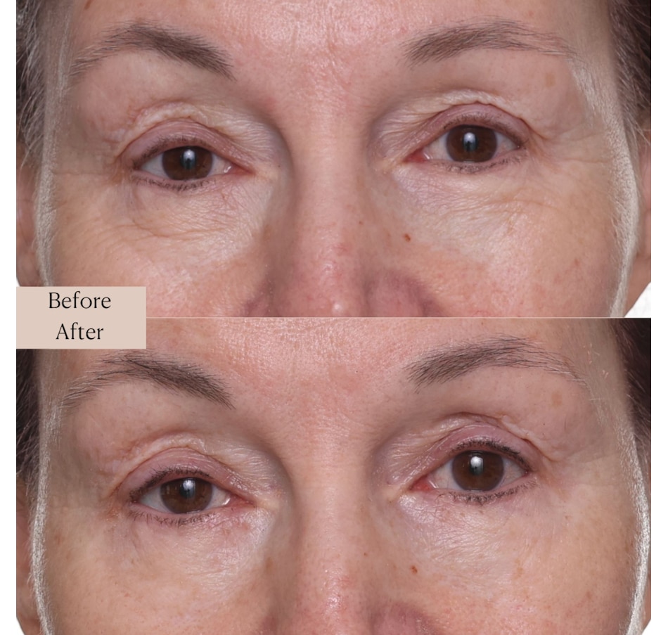 Image 112849_ALTMORE5.jpg, Product 112-849 / Price $39.50, Nakery SkinRepair Retinol Deep Wrinkle Serum from Nakery Beauty on TSC.ca's Beauty department