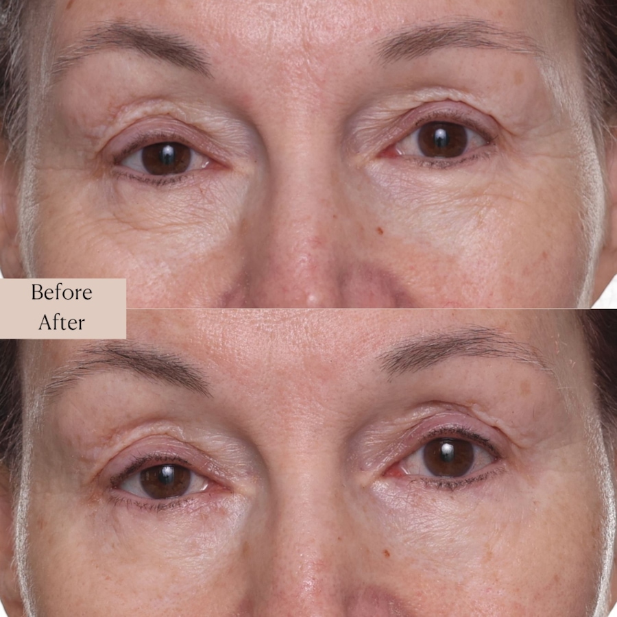 Image 112849_ALTMORE5.jpg, Product 112-849 / Price $57.00, Nakery SkinRepair Retinol Deep Wrinkle Serum from Nakery Beauty on TSC.ca's Beauty department