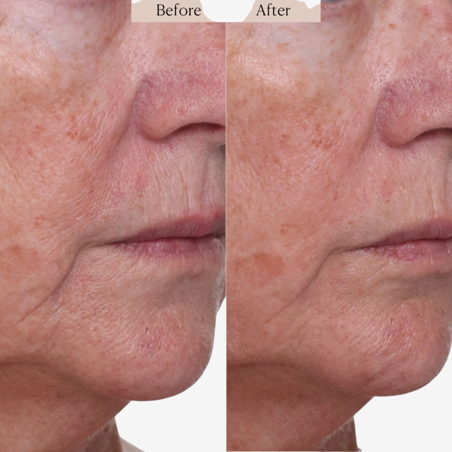 Image 112849_ALTMORE6.jpg, Product 112-849 / Price $57.00, Nakery SkinRepair Retinol Deep Wrinkle Serum from Nakery Beauty on TSC.ca's Beauty department