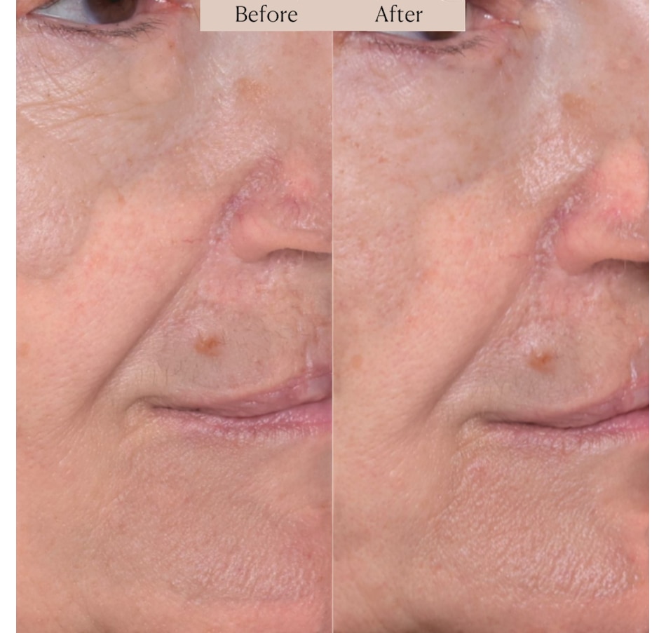 Image 112849_ALTMORE7.jpg, Product 112-849 / Price $39.50, Nakery SkinRepair Retinol Deep Wrinkle Serum from Nakery Beauty on TSC.ca's Beauty department