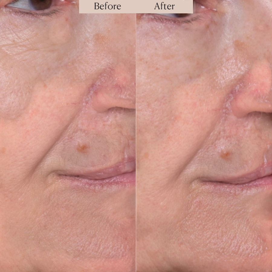 Image 112849_ALTMORE7.jpg, Product 112-849 / Price $57.00, Nakery SkinRepair Retinol Deep Wrinkle Serum from Nakery Beauty on TSC.ca's Beauty department