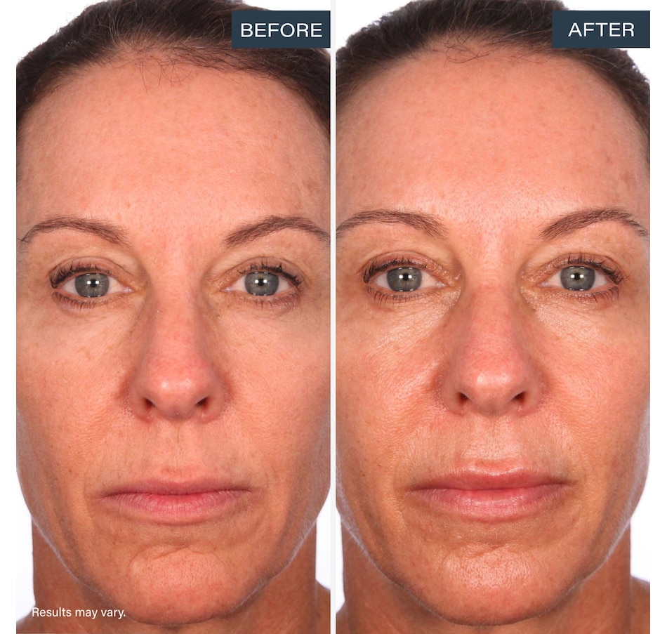 Image 113639_ALTMORE10.jpg, Product 113-639 / Price $75.00, SKINN Divine Luminous Firming Cream + Forehead Patch from SKINN on TSC.ca's Beauty department