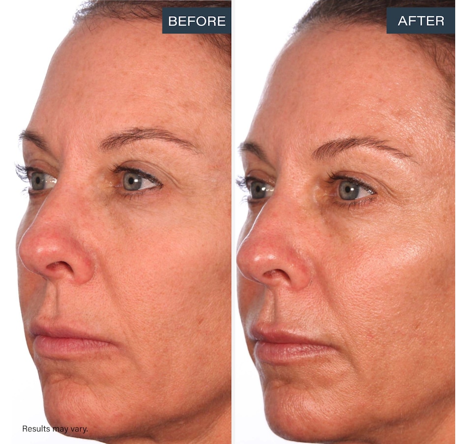 Image 113639_ALTMORE11.jpg, Product 113-639 / Price $75.00, SKINN Divine Luminous Firming Cream + Forehead Patch from SKINN on TSC.ca's Beauty department