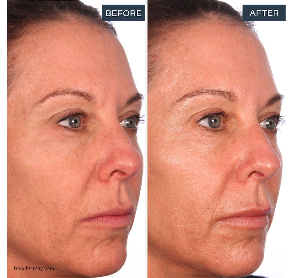 Image 113639_ALTMORE12.jpg, Product 113-639 / Price $75.00, SKINN Divine Luminous Firming Cream + Forehead Patch from SKINN on TSC.ca's Beauty department