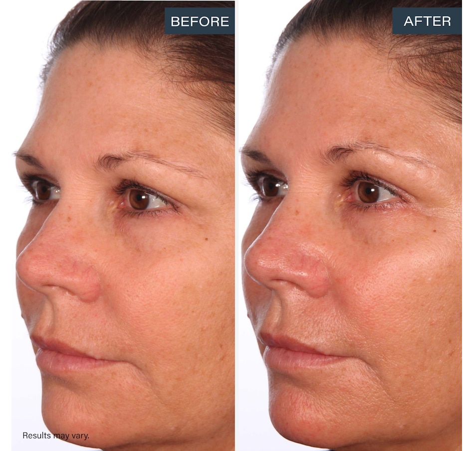 Image 113639_ALTMORE7.jpg, Product 113-639 / Price $75.00, SKINN Divine Luminous Firming Cream + Forehead Patch from SKINN on TSC.ca's Beauty department