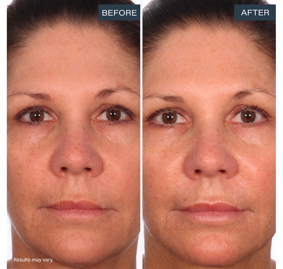 Image 113639_ALTMORE8.jpg, Product 113-639 / Price $75.00, SKINN Divine Luminous Firming Cream + Forehead Patch from SKINN on TSC.ca's Beauty department